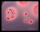 Escherichia coli on MacConkey