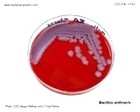 cause of anthrax