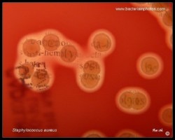 staph colonies and beta bemolysis around them