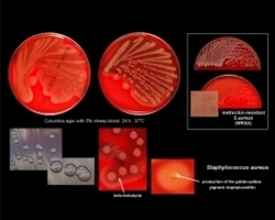 s.aureus on microbiologyinpictures