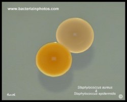 staph aureus and staph epidermidis colony