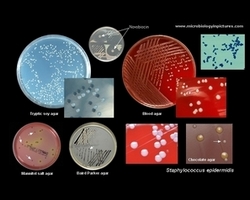 s.epidermidis on microbiologyinpictures
