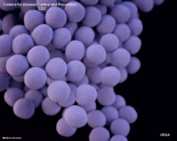 VRSA (Vancomycin-resistant Staphylococcus aureus)