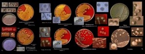 bacteria
