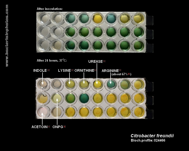 bacteria identification C.freundii