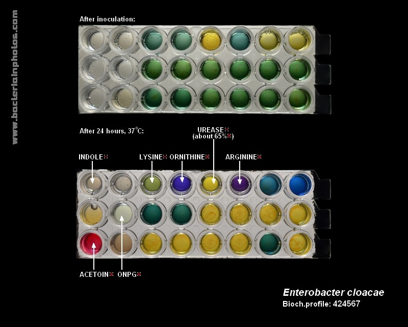 bacteria identification E.cloacae