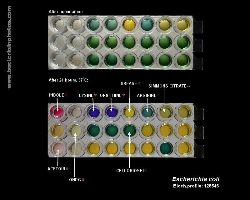 bacteria identification E.coli