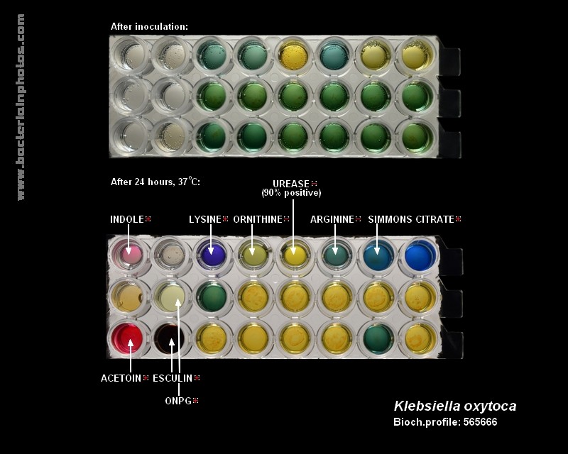 bacteria identification K.oxytoca