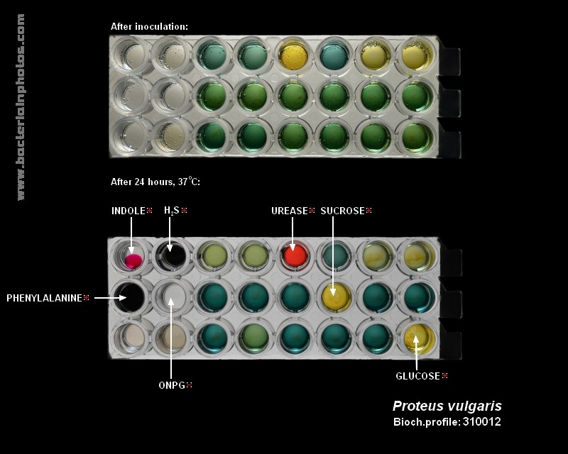 bacteria identification proteus