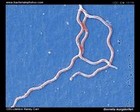 Borrelia