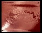 clostridium