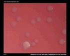 Enterococcus faecalis gamma hemolysis