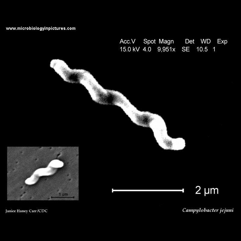 Campylobacter jejuni electron microscopy, SEM