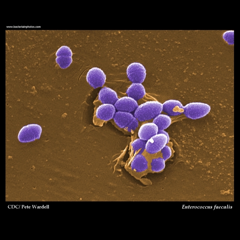 Enterococcus faecalis electron microscopy, SEM