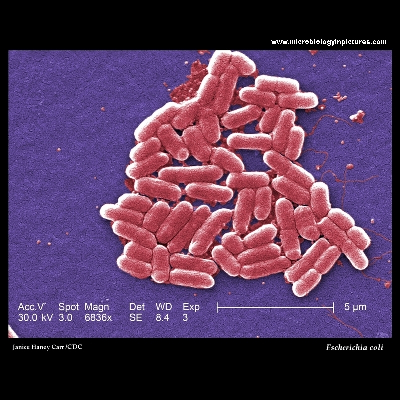 Escherichia coli  electron microscopy