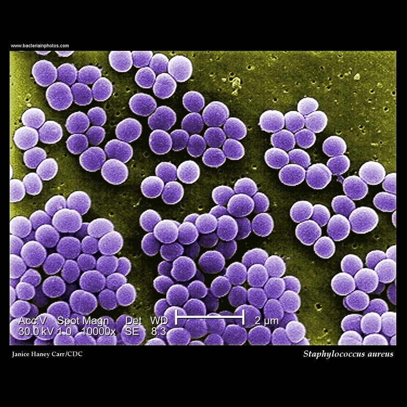 Staphylococcus aureus electron microscopy