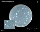 Enterococcus faecalis on agar plate