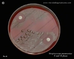 optochin test with pneumococcus