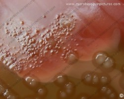 bile solubility test