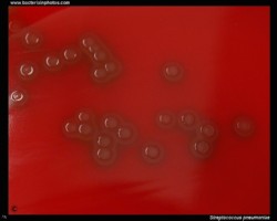 Streptococcus pneumoniae colony morphology