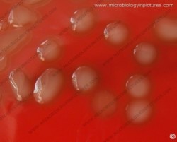 Streptococcus pneumoniae hemolysis on blood agar