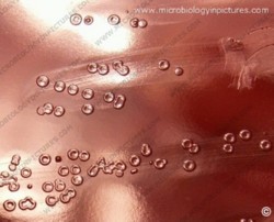 pneumococcus pinpoint colonies of an avirulent strain