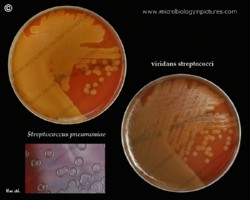 Avirulent pneumococci and viridans streptococci comparison