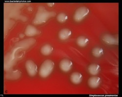 pneumococcus virulent strain