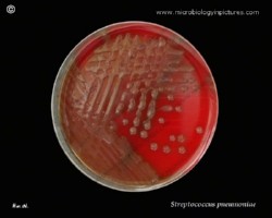 virulent, mucoid colonies of pneumococci on blood agar
