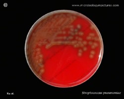 Virulent strain of S.pneumoniae