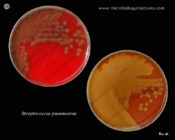 Virulent and avirulent pneumococci