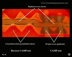 CAMP, reverse CAMP test
