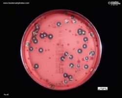 Beta and gamma hemolysis on blood agar
