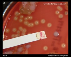 GAS positive PYR test
