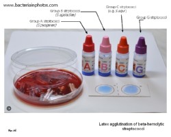 agglutination of streptococci