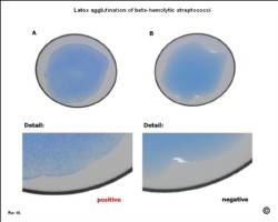 streptococci latex agglutination