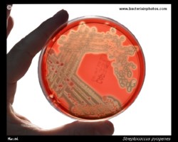 GAS in Petri dish