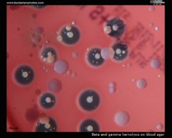 Beta and gamma hemolysis