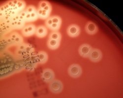 Streptococcus pyogenes colonies with hemolysis on blood agar