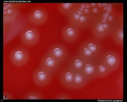 Streptococcus pyogenes