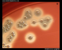 GAS (Group A Streptococci)