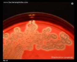 S.pyogenes