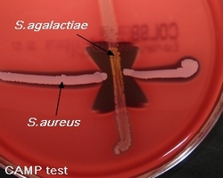 CAMP test with S.agalactiae