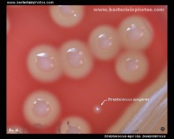 strep zooepidemicus colonies