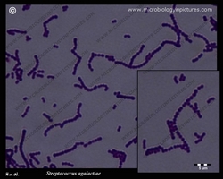 streptococcus GBS gram stain; micrograph