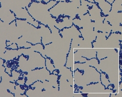 streptococcus aglactiae gram stain; micrograph