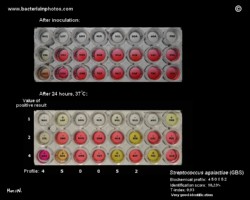 biochemical tests for identification of streptococcus agalactiae (GBS)