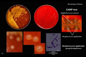 group B streptococcus