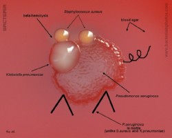 Bacteria bacteria