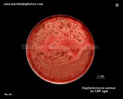 images of staph aureus, colonies of golden staph on blood agar plate